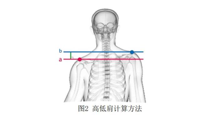 《儿童青少年身体姿态测试指标与方法》中高低肩的计算方法。