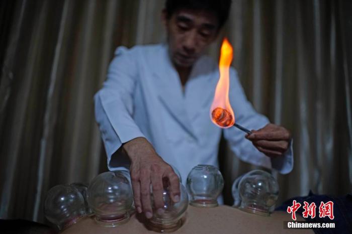 资料图:天津,市民在一家中医推拿馆感受拔火罐。中新社记者 佟郁 摄 资料图:天津,市民在一家中医推拿馆感受拔火罐。/p中新社记者 佟郁 摄