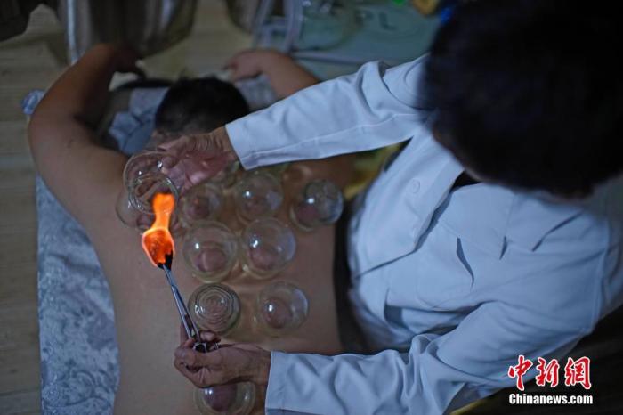 资料图:天津,市民在一家中医推拿馆感受拔火罐。中新社记者 佟郁 摄 资料图:天津,市民在一家中医推拿馆感受拔火罐。/p中新社记者 佟郁 摄